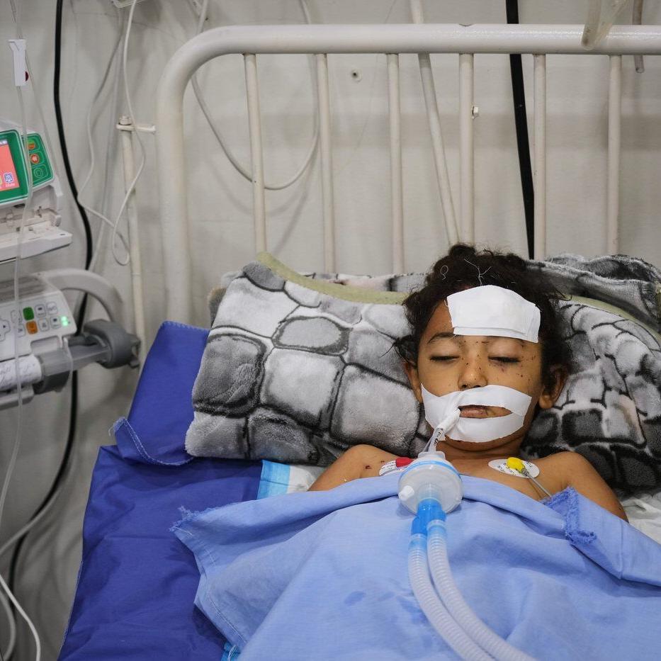 A bomb in Gaza's rubble wounds twins who thought it was a toy